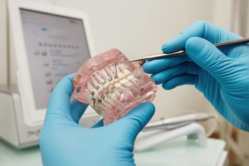 Exploring Orthodontic Treatments: What You Need to Know About Braces and Aligners