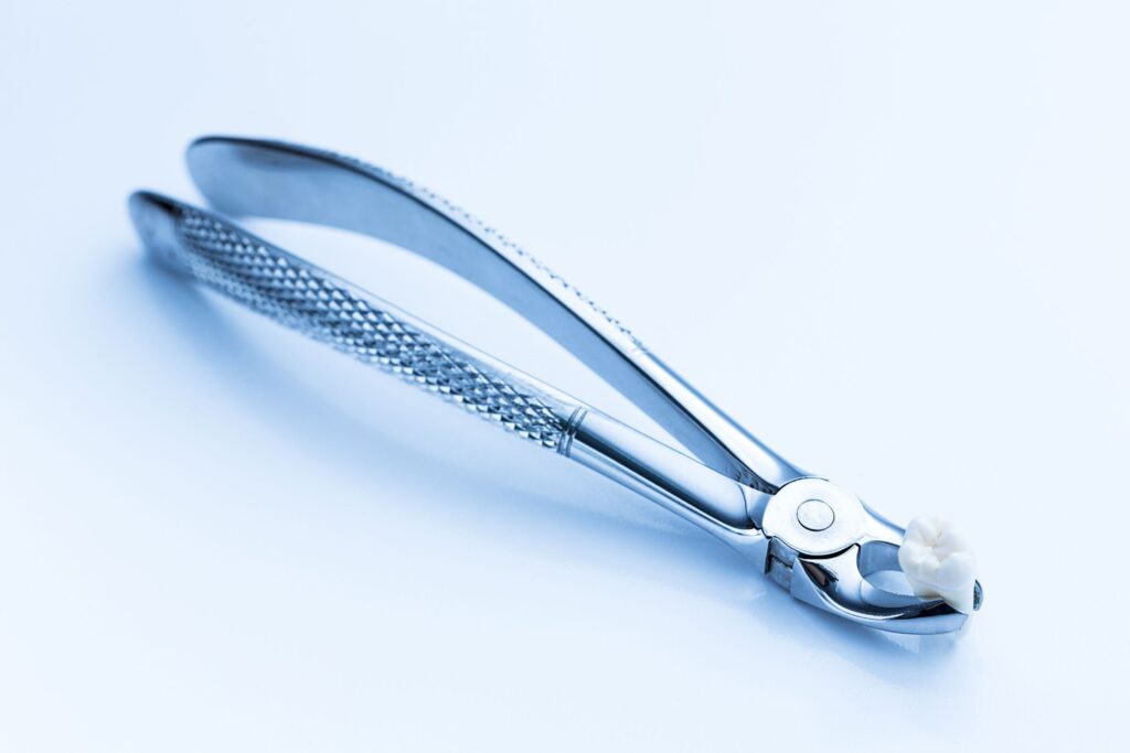 Tooth Extraction Made Easy: A Complete Patient Guide