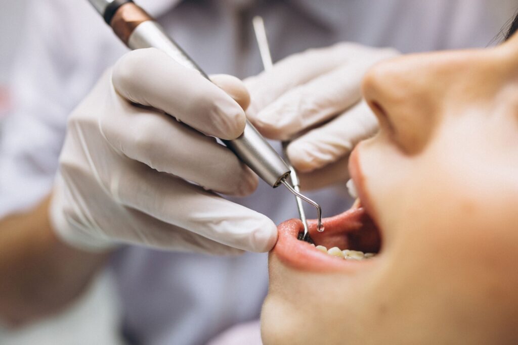 Dental Treatment for Nervous Patients at KAA Dentals